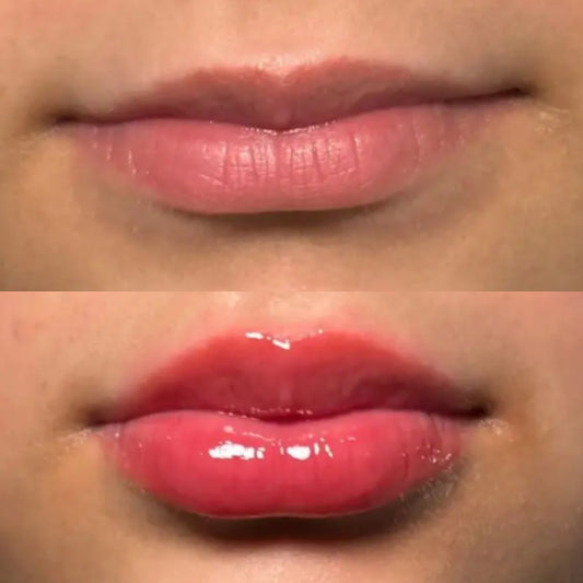 ✨ Instant Filler Lips – 5ml ✨ lasts 2+ months