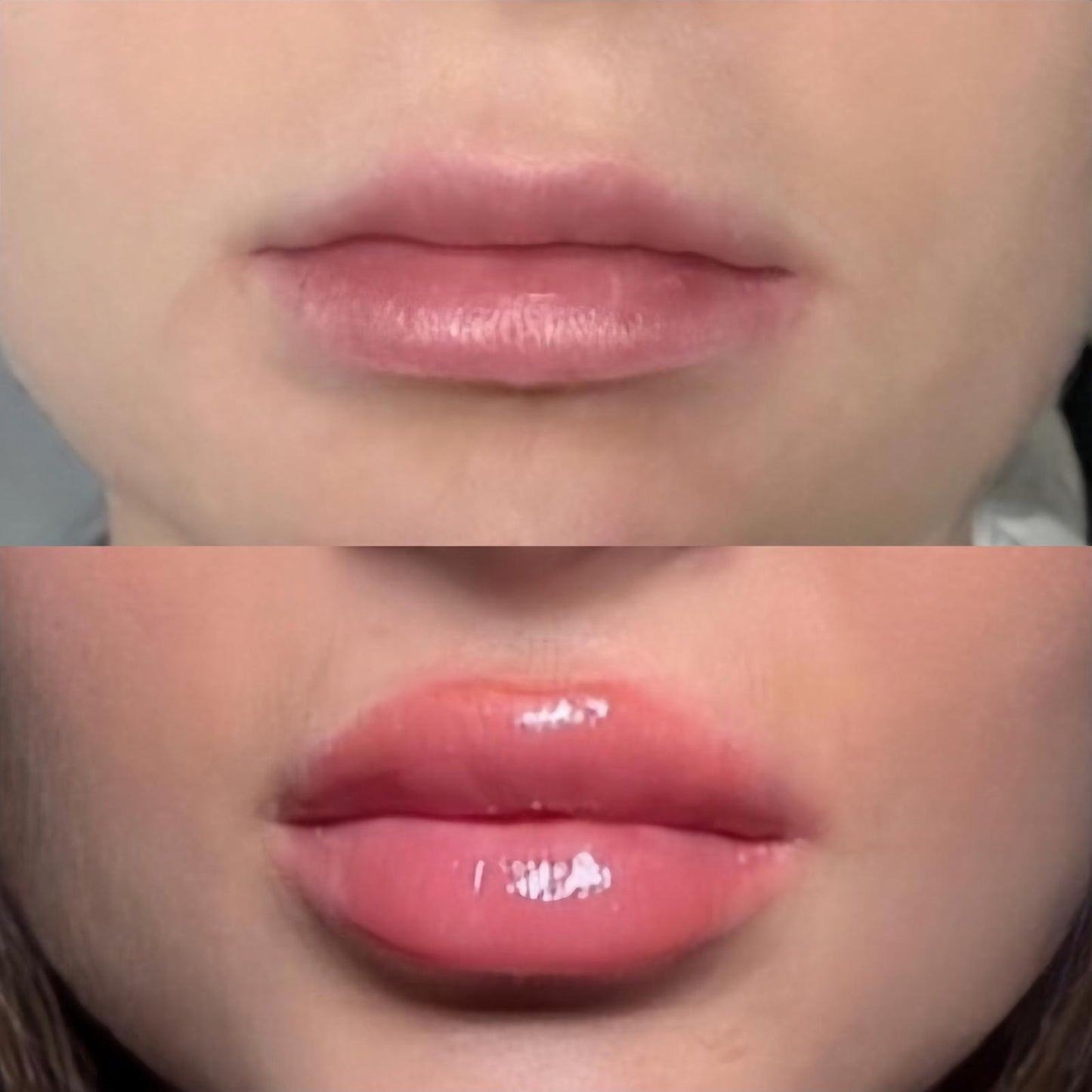 ✨ Instant Filler Lips XL – 20ml ✨Pre-Order