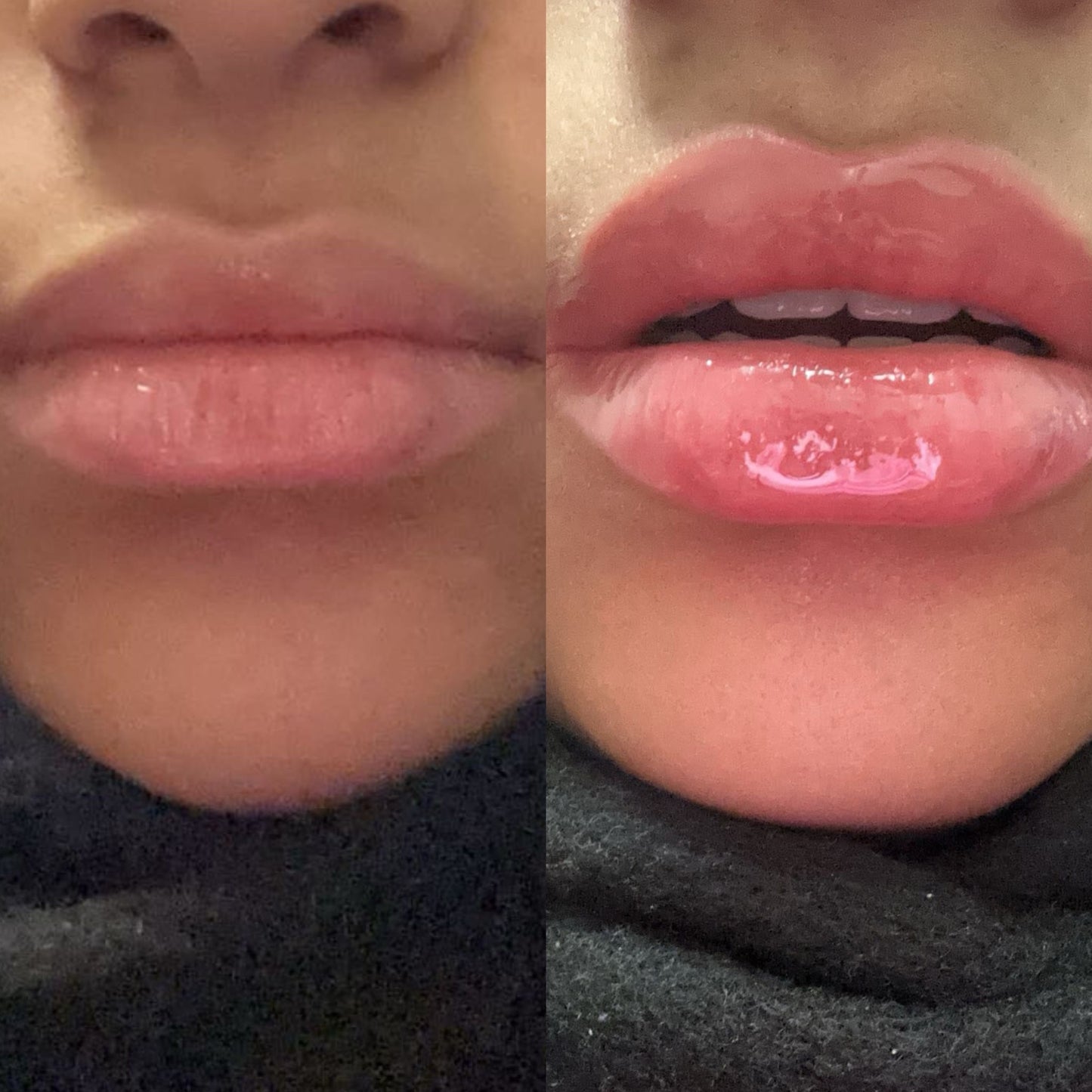 ✨ Instant Filler Lips – 5ml ✨