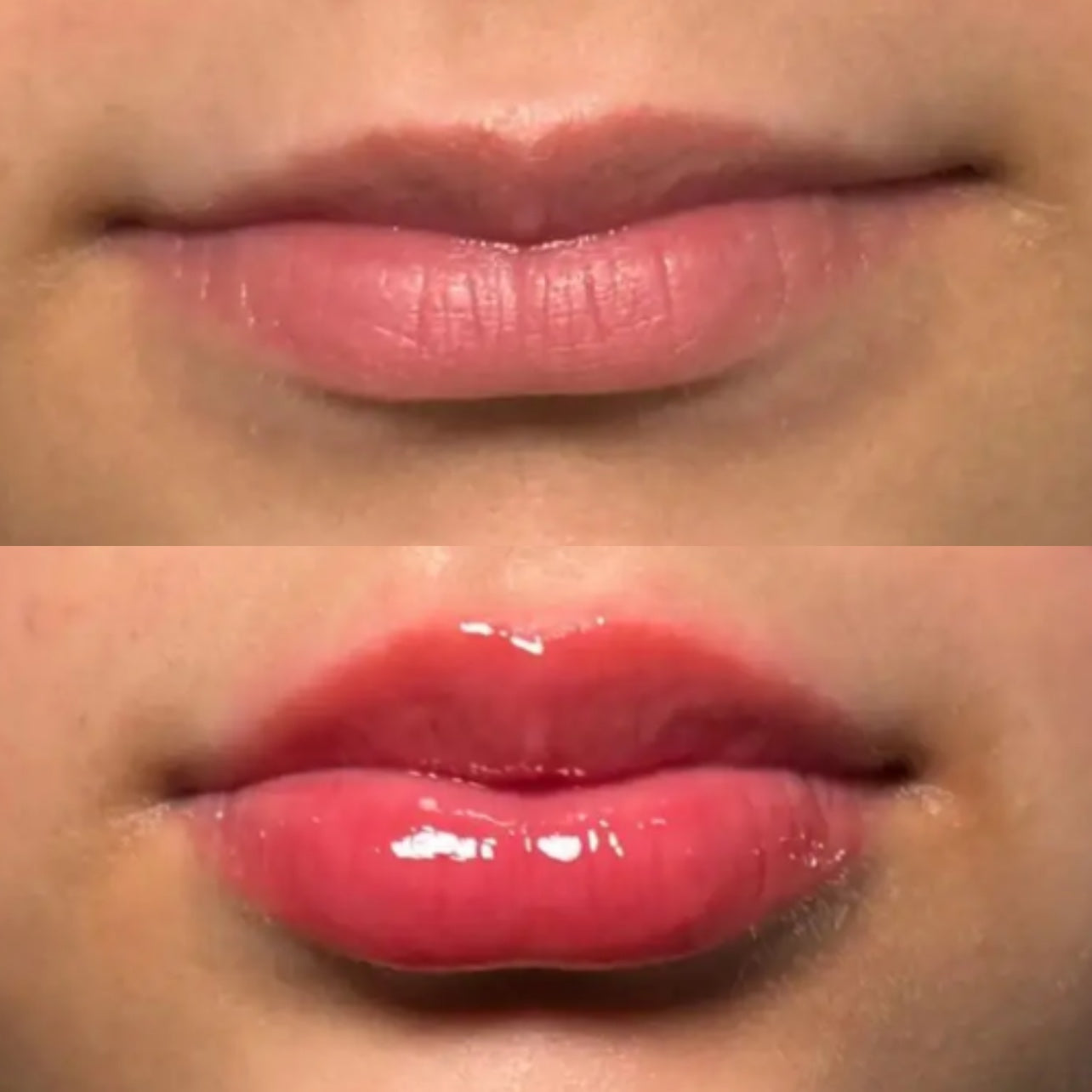 ✨ Instant Filler Lips – 5ml ✨
