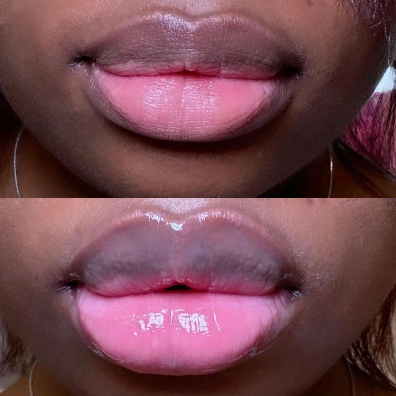 ✨ Instant Filler Lips XL – 20ml ✨Pre-Order
